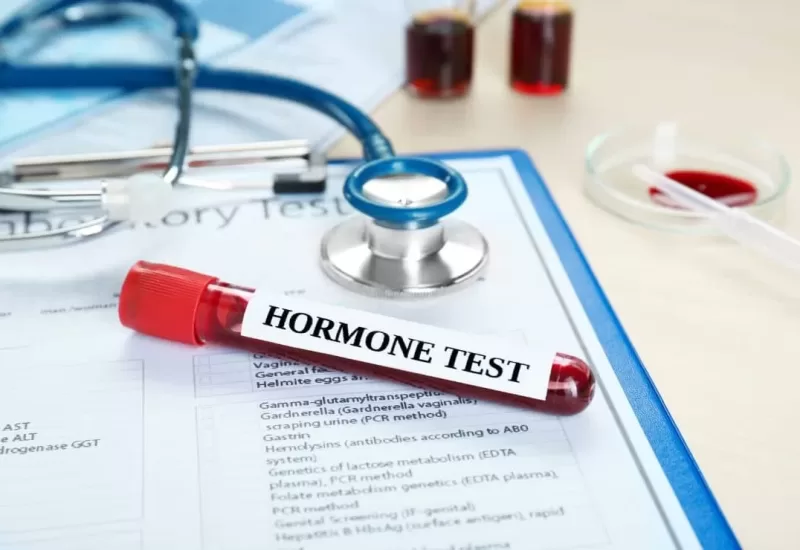 Hormone Profile